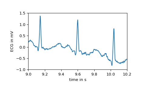 ../_images/scipy-misc-electrocardiogram-1_00_00.png