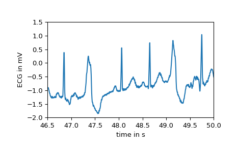 ../_images/scipy-misc-electrocardiogram-1_01_00.png