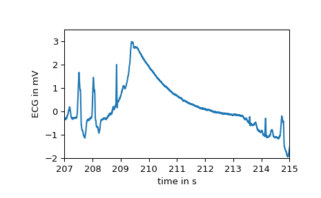 ../_images/scipy-misc-electrocardiogram-1_02_00.png